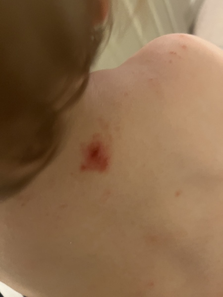 Does this look/sound like eczema?