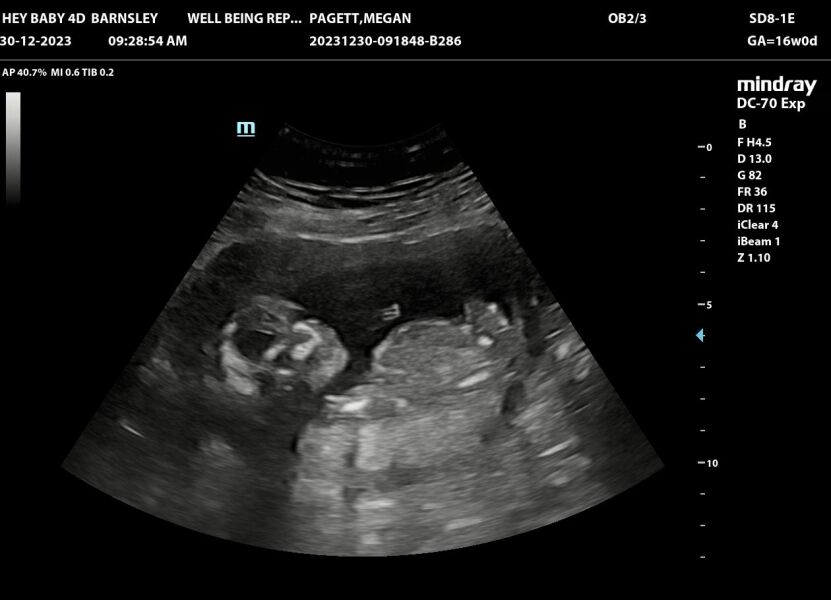 Due June 24 💚 - Part 2