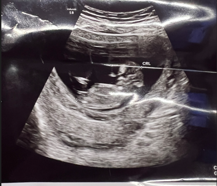 Boy or Girl