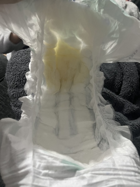 urine output