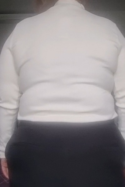 Think you've got problems? Look at my back:(