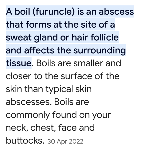 Do boils normally get more painful as they come to a head?