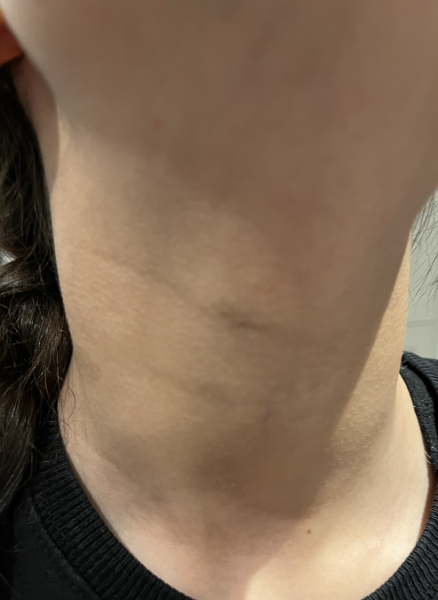 What is this on DD neck?
