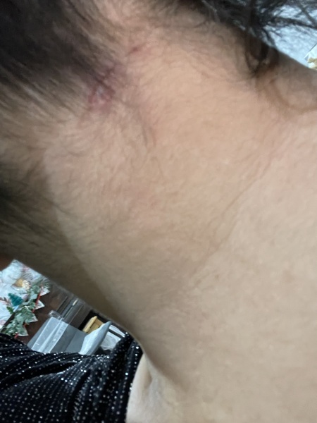 Does this need antibiotics?