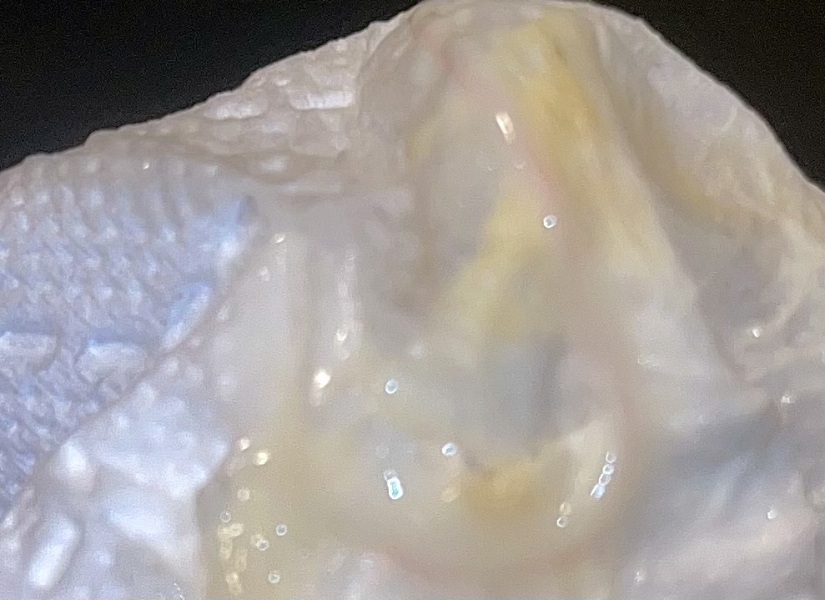 Mucus plug? TMI pic