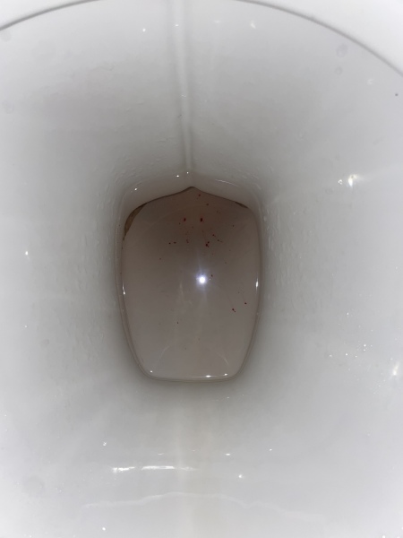 Is this classed as implantation bleeding
