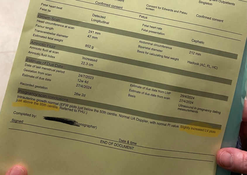 Slightly increased LV