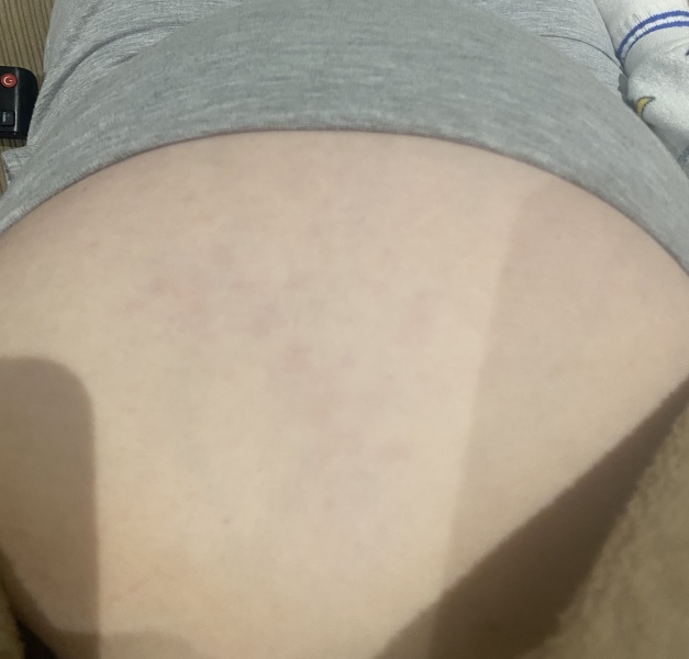 Sore area on stomach??