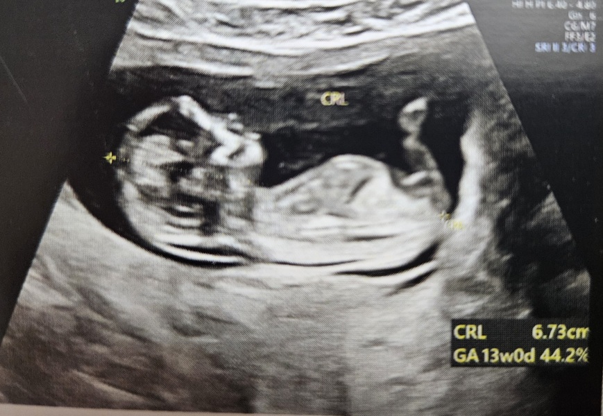 Help me identify the gender, please!