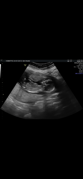 Gender Guesses?