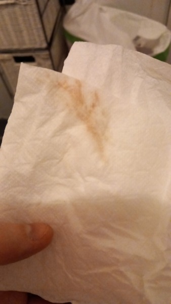 (TMI) Bleeding at 33 weeks pregnant. WARNING PICS