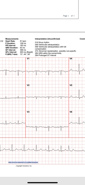 Anyone know anything about ECGs?