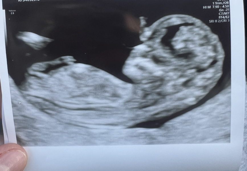 Gender Guesses?