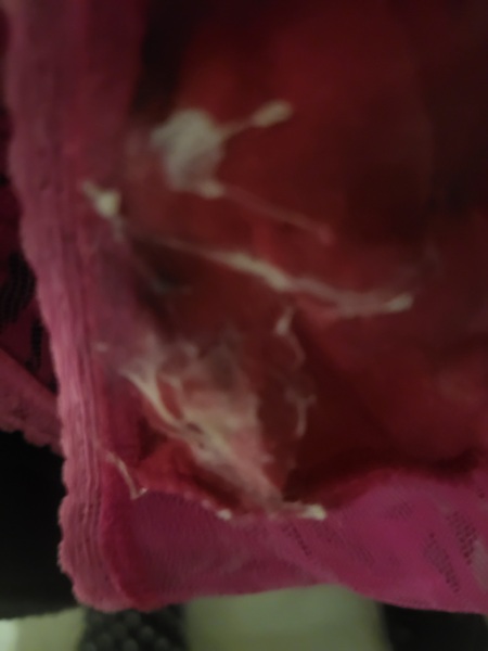 Is this early pregnancy discharge?