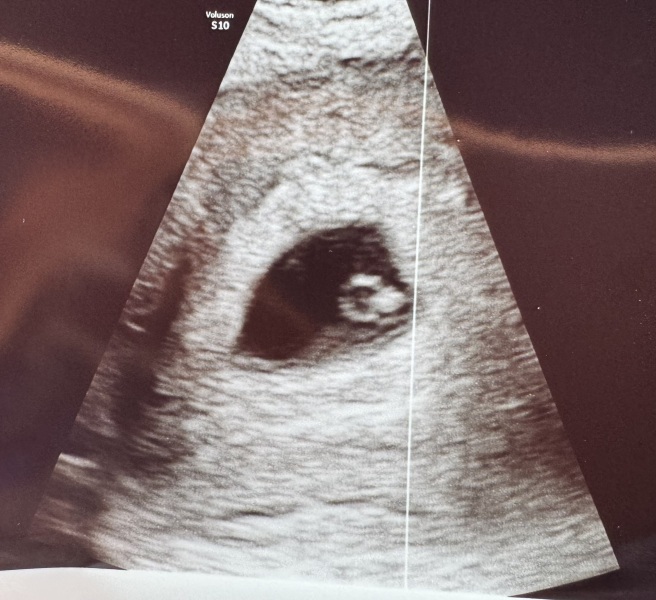 Due September 2024 PART 3 ❤️🩷💛💚💙💜