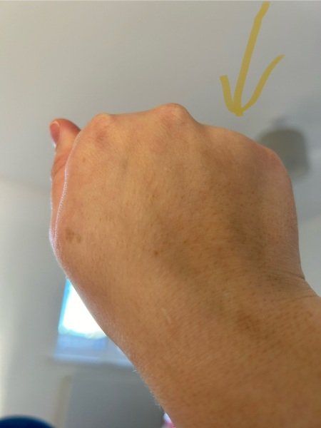 My knuckle is missing!