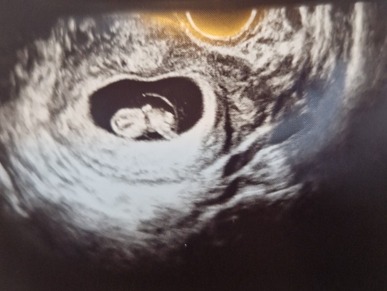 Due September 2024 PART 3 ❤️🩷💛💚💙💜