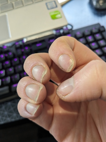 Nails breaking all the time
