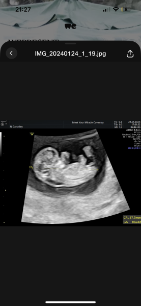 Nuchal Translucency