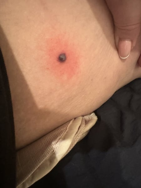 Can anyone identify this lump? (Medical, graphic photo!)