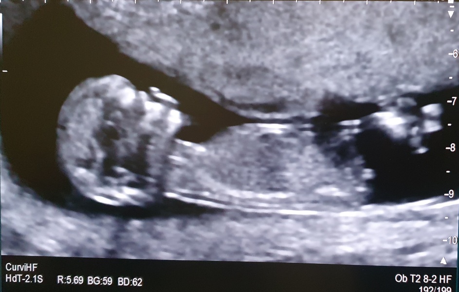 Gender/Nub Guesses (3pics).