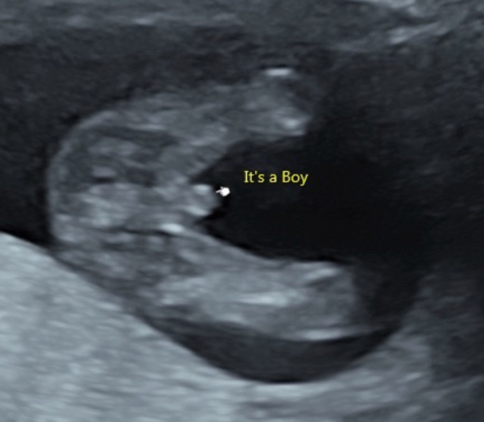 Is it REALLY looking like a girl?? May I have your opinion please?
