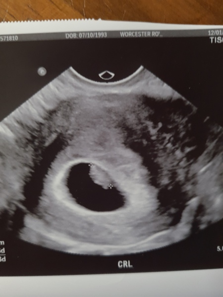 6 weeks pregnant. Sudden faint positive