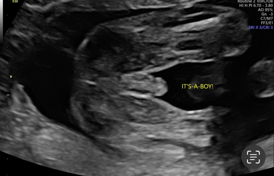 Nub theory - confused by scan