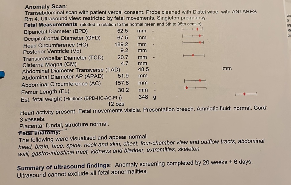 20 week scan results, anyone else?