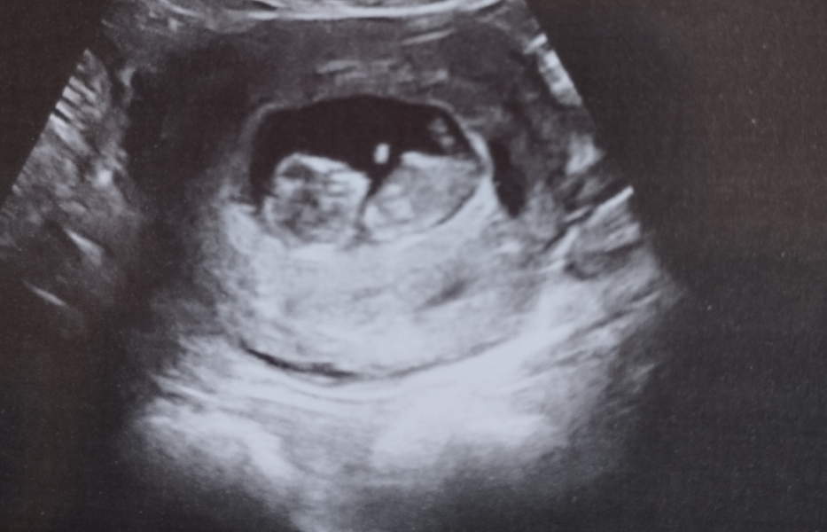 TTC May 2023 💖 Previous MC March 2023 (thread 3)