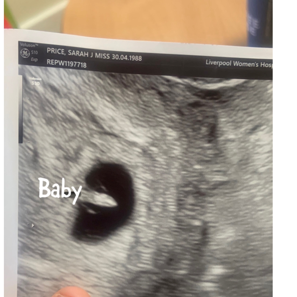 Due September