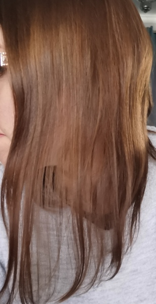 Thin hair destroying confidence