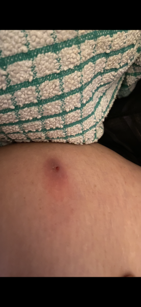 Ouch!!