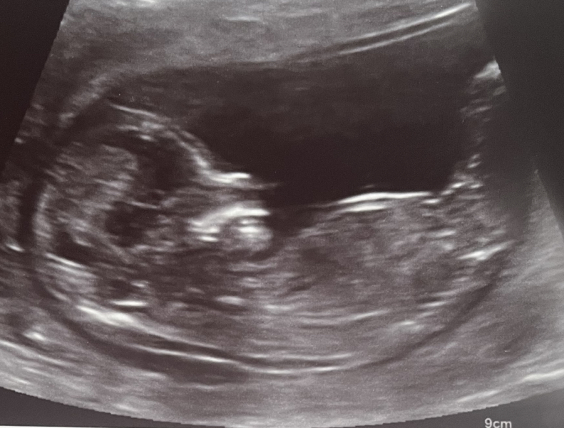 Any guesses?