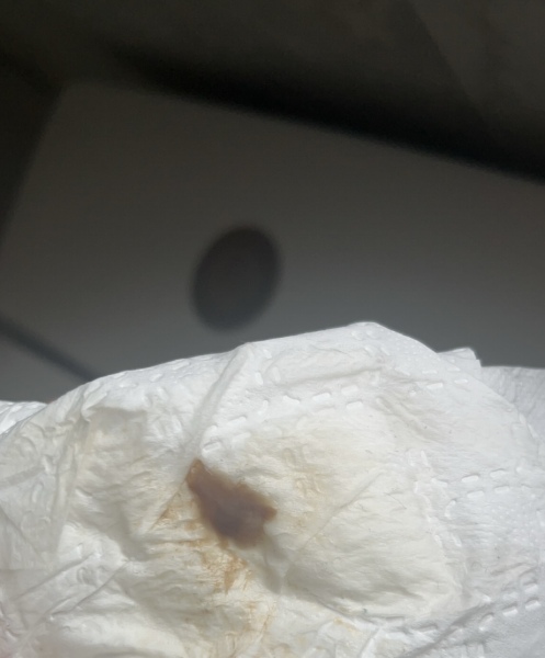 Lots of dark brown discharge