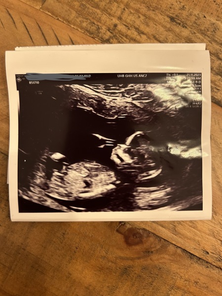 May 24 FTM