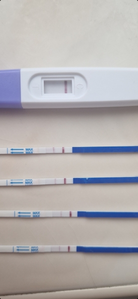 Rainbow after ectopic