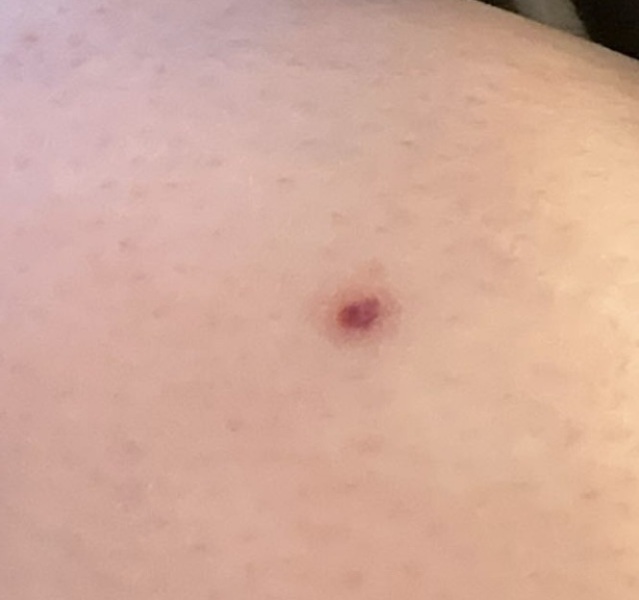 Could this be skin cancer ???