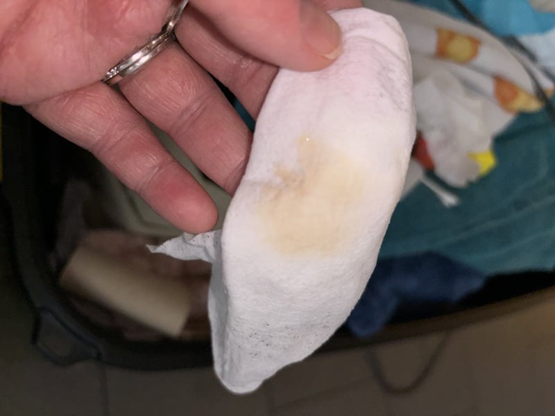 Graphic image. Is this implantation bleeding ?