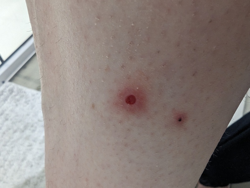 Why won't my leg heal - pic attached