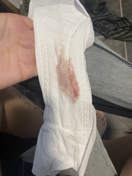 Miscarriage? Infection?