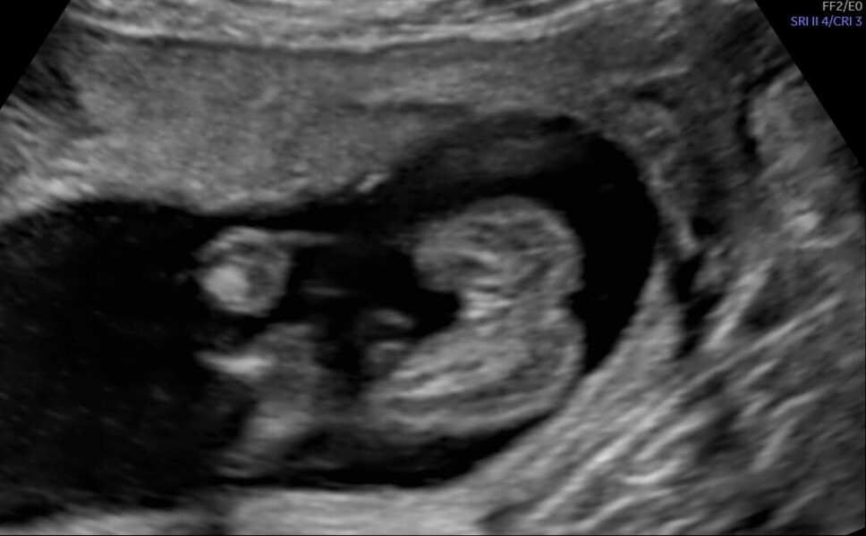 Boy or Girl?- Take a guess! :)
