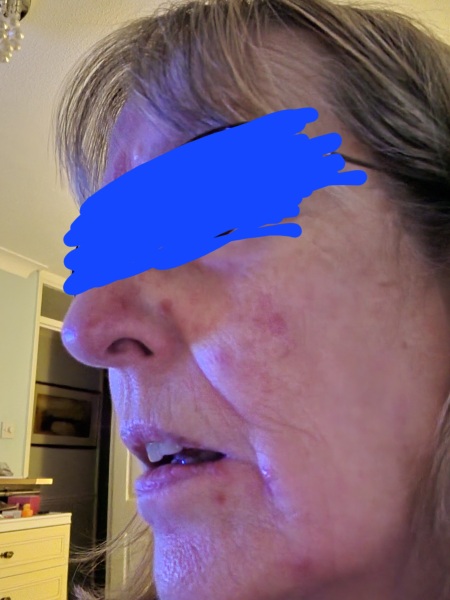 What are these on my face?
