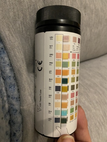 Urine dip test - infection?
