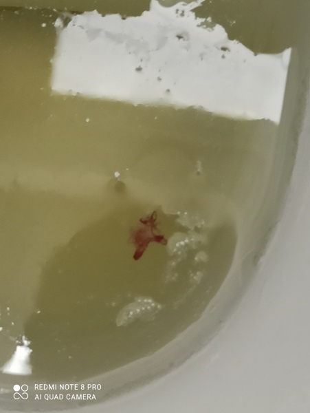 is this a miscarriage?