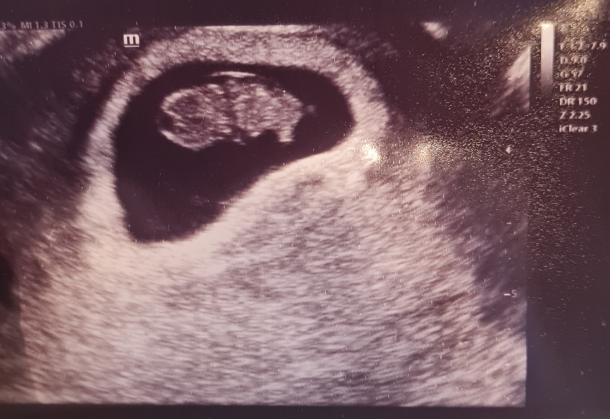 Due September 2024 PART 2 💛🧡💚💙💜