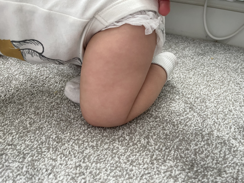 To be worried about my babies development?