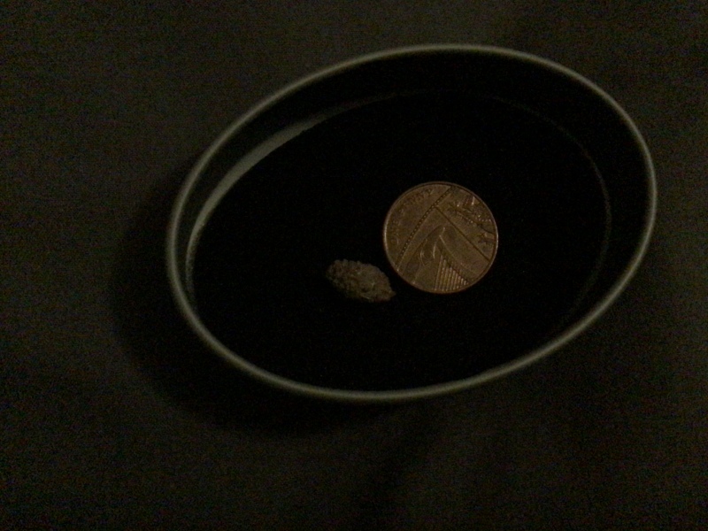 The best thing your body has produced *warning-grim content not suitable for weak-stomached persons*