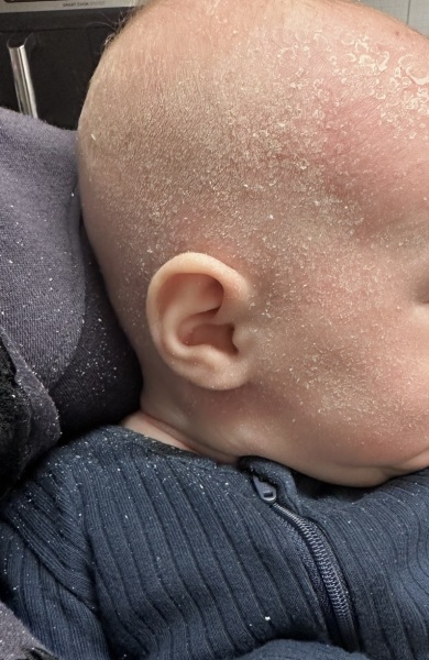 HELP - Baby skin