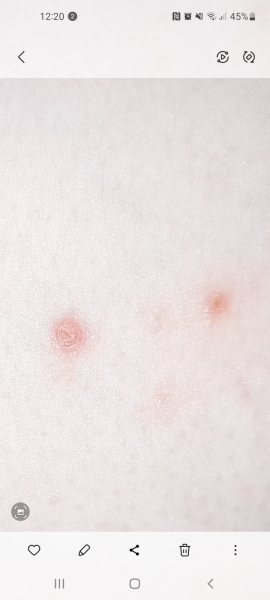 Is this chicken pox and does it always itch